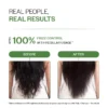 Bare Anatomy - Anti - Dandruff Conditioner (175g)