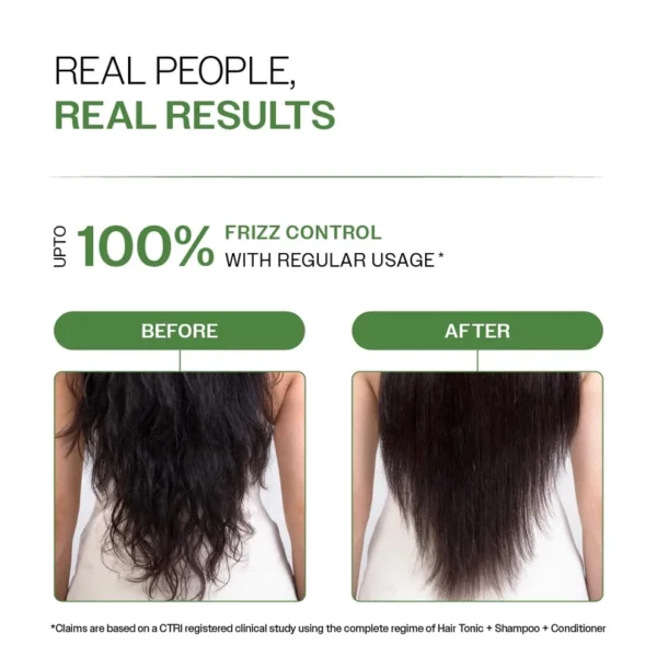 Bare Anatomy - Anti - Dandruff Conditioner (175g)